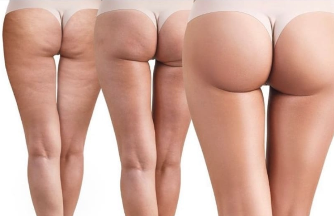 Změna stavu pokožky v průběhu 3 měsíců